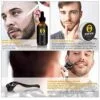 Beard Derma Roller Image 3